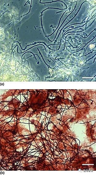 ��Ʒ�|(zh��)Ҭ������̿�S����Û����ĭ��M. parvicella���ĺ���